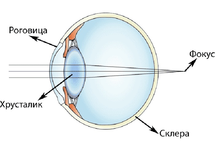 Рисунок дальнозоркого глаза